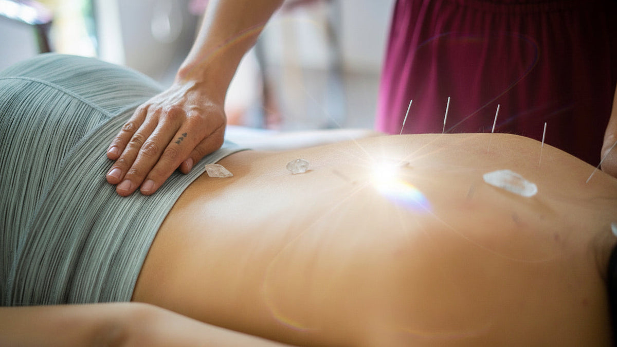 A close-up lifestyle shot of a person receiving a back treatment, with a therapist's hand on their back and several acupuncture needles inserted. The person is wearing a gray-green pleated top and a magenta dress, with a small rainbow reflection on the skin.